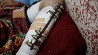 Shattered Limbs, Broken Dreams: Life for Gaza Athletes after Surviving Israeli Bullets