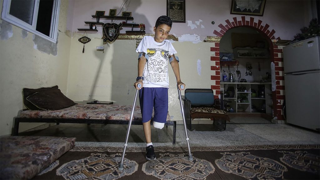 11-year-old boy, who lost his leg after Israeli soldiers opened fire