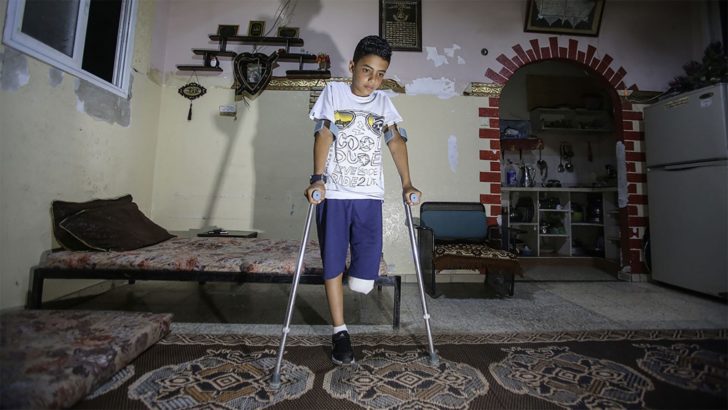 Hundreds of Gaza protesters shot by Israeli forces risk limb amputation