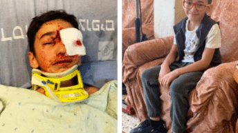 Palestinian child, shot in head by Israeli soldier, hemorrhaging in brain