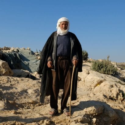 Israeli Settlers Severely Beat 78-Year-Old Palestinian Man