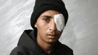 Ten Days, Five Israeli Bullets, Five Bedouin With Serious Head Injuries