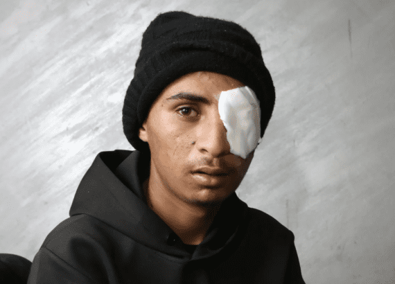 Ten Days, Five Israeli Bullets, Five Bedouin With Serious Head Injuries