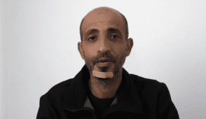 44-year-old Bassem Abu-Rabia was one of four Bedouin hit in the head by the hard sponge-tipped bullets in a demonstration near Be’er Sheva, Israel.