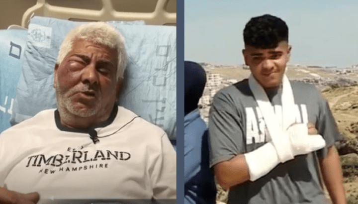 Israeli Colonizers Attack Palestinian Man And His Son