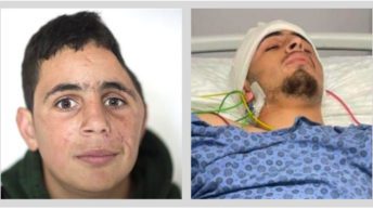 Palestinian youth survived Israeli bullet in 2017, survives assassination attempt in 2022
