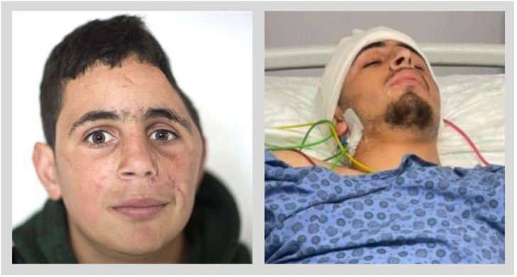 Palestinian youth survived Israeli bullet in 2017, survives assassination attempt in 2022