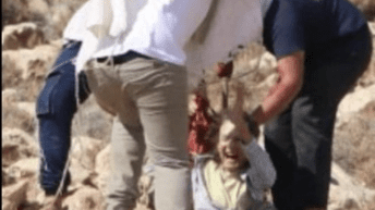 Israeli settlers stab int’l female activist, break her leg