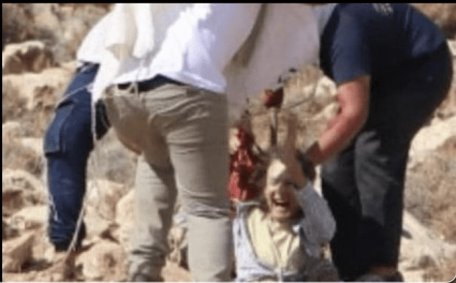 Israeli settlers stab int’l female activist, break her leg