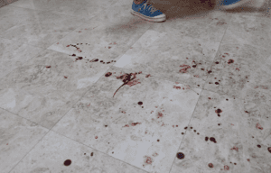 It’s not clear where Shadi bled from, but later that morning, after his arrest, the stains and drops remained everywhere.