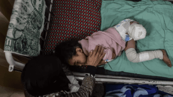 9,000 Gazan children have undergone amputations, many without anesthesia – Day 81
