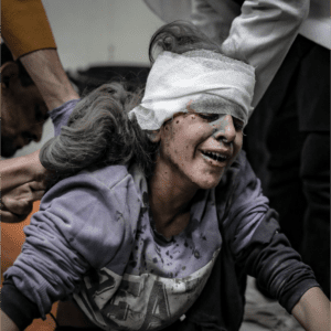 A child suffered injuries and burns all over her body after the bombing of Al-Amal Hospital in the city of Khan Yunis. Photo: Belal Khaled