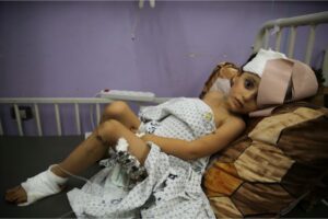 A child wounded in Israeli bombardment lies at Al-Aqsa Hospital in Deir el-Balah