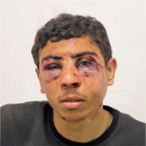 a victim of Israeli torture