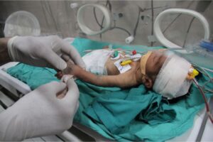 A baby, hospitalised due to malnutrition and dehydration, lies in an incubator at Kamal Adwan Hospital in Beit Lahiya, Gaza