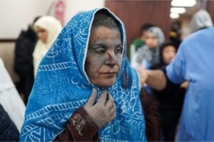 An injured Palestinian woman walks in the emergency area in Al-Aqsa Martyrs Hospital in Deir el-Balah on March 19, 2024, following Israeli bombardment in the Nuseirat refugee camp in the central Gaza Strip
