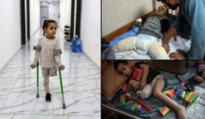 Save the Children reports that more than 10 children on average have lost one or both of their legs every day in Gaza since October 7, with many amputations performed without anesthesia