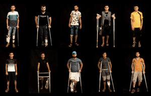 Palestinians shot in the legs during demonstrations at the Gaza Strip’s border with Israel.