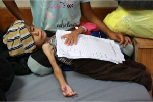 A malnourished Palestinian child lies at Al-Aqsa Martyrs Hospital in Deir el-Balah in the central Gaza Strip on May 30, 2024