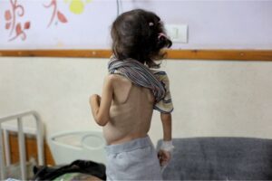 Gaza is witnessing the worst levels of malnutrition, according to Save the Children’s Alexandra Saieh