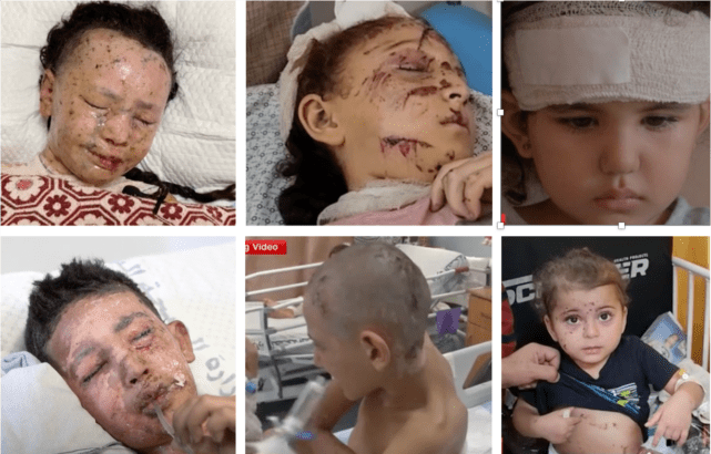 Israel vows to improve safety for aid workers, then kills 4 aid workers; uses horrific shrapnel-producing weapons against children – Day 278
