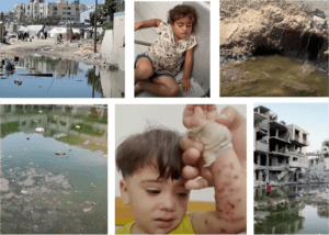 After Israel destroyed Gaza's water and sewage systems, filthy water runs or stands stagnant all over the enclave, carrying polio and other diseases.