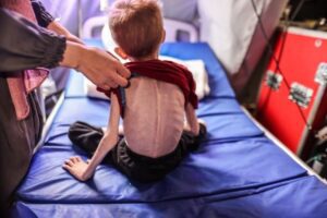 Human Rights Watch met F., age 9, who was experiencing malnutrition; he received treatment after being evacuated from the northern Gaza Strip to the IMC field hospital in Rafah, Gaza, March 24, 2024.