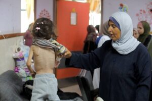 A Palestinian child suffering from malnutrition receives treatment with limited facilities at the Al-Aqsa Martyrs Hospital in Deir al-Balah, Gaza on June 01, 2024