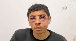 A victim of Israeli torture who gave testimony to Euro-Med Human Rights Monitor in February, 2024.