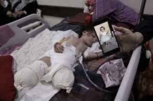 Shefa holds a mobile showing Hanan before an Israeli bomb destroyed her legs.