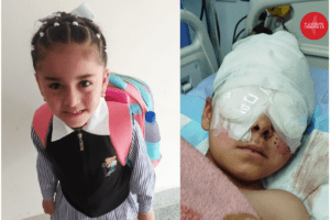 Jannat Mtour, 8, was blinded by Israeli soldiers in Hebron.