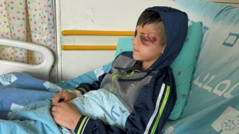 Palestinian Boy Nearly Loses Eye After Israel Border Police Rubber Bullet Hits Him in East Jerusalem
