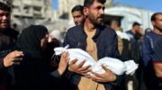 This baby joins thousands of Gazans in need of medical evacuation
