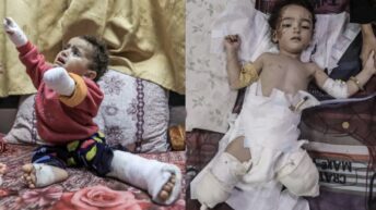 Ten children lose legs every day in Gaza: UN – War on Gaza Day 649