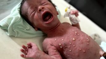 ‘Worst-case scenario of famine’ unfolding in Gaza – War on Gaza Day 662