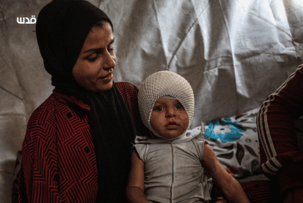 Israel’s “ceasefire” in Gaza includes shooting children in the head – Daily Update Israel’s “ceasefire” in Gaza includes shooting children in the head – Daily Update