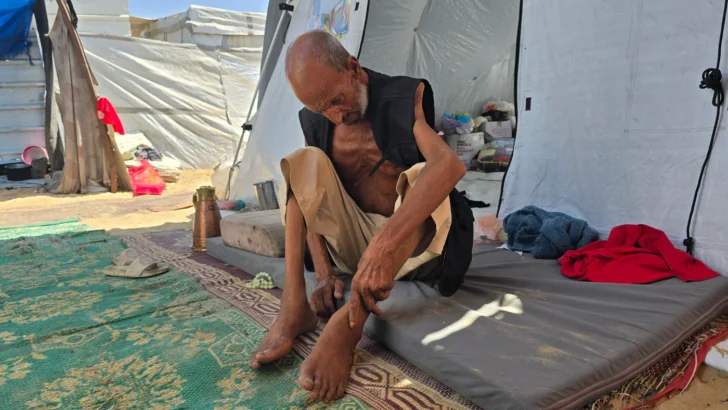 ‘No heartbeat’: Gaza’s pregnant and elderly bear brunt of Israel’s starvation ‘No heartbeat’: Gaza’s pregnant and elderly bear brunt of Israel’s starvation