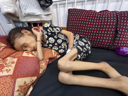 The hunger we face in Gaza is Israel’s weapon of war. Please don’t look away.