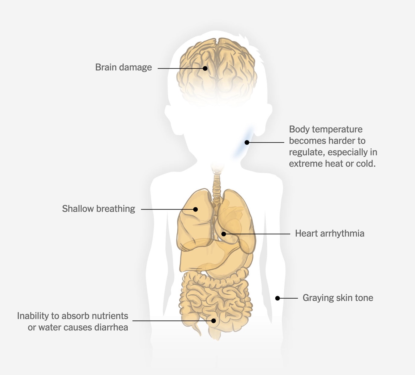 4. Organs fail. Any movement not necessary for survival stops. Temperature control collapses, breathing slows and blood pressure drops.