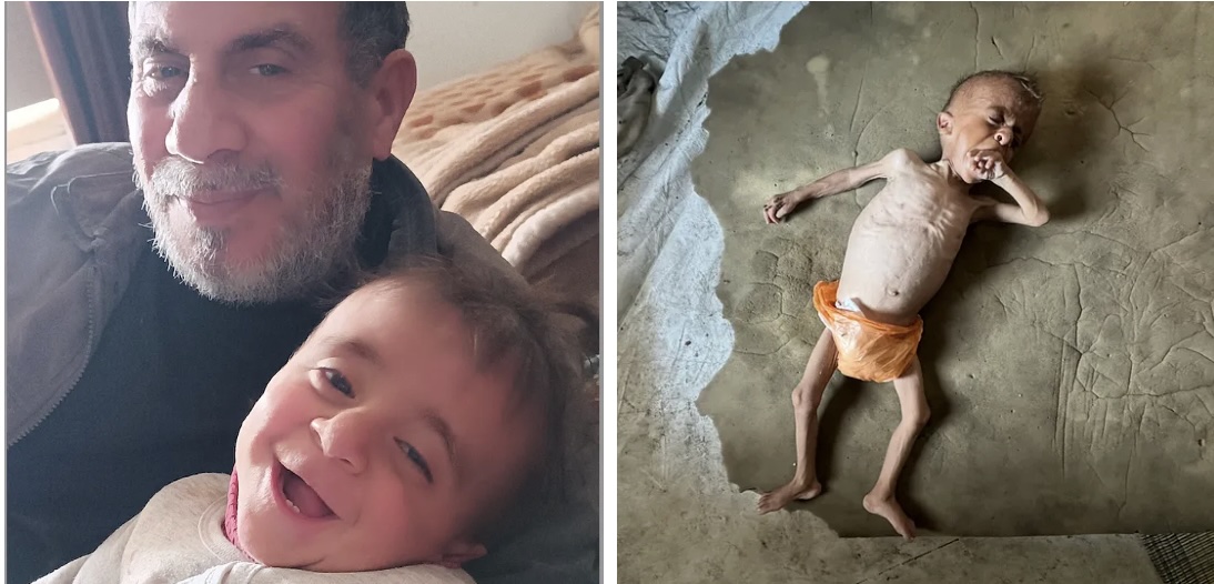 Left: Muhammad Zakariya Ayyoub al-Mutawaq, with his father, Zakariya, before the full-spectrum blockade launched by Israel on March 2. Right: After.