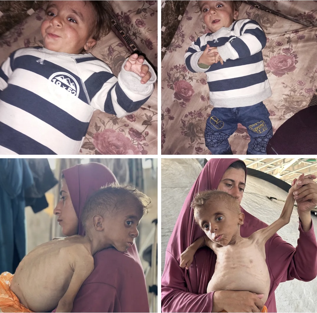 Top: Muhammad 12 days before the Israeli siege launched on March 2, 2025. Bottom: Muhammad with his mother, Hedaya al-Mutawwaq.