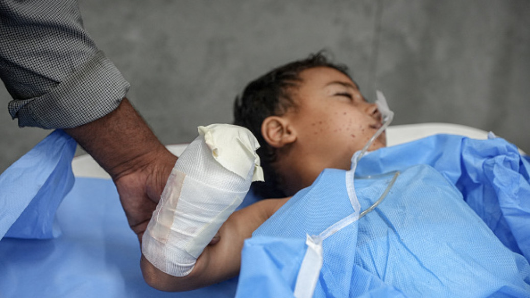 Doctors say that the Shorbasi twins have life-threatening injuries including a lost hand, a hole in the bowel, broken bones and potential loss of a leg