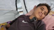 Acute trauma: The ever-present wounds of Gaza’s children from Israel’s war