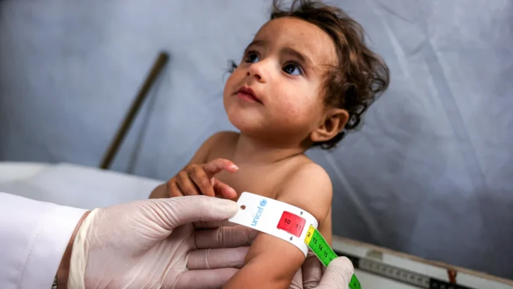 Rising maternal malnutrition in Gaza drives up newborn mortality Rising maternal malnutrition in Gaza drives up newborn mortality