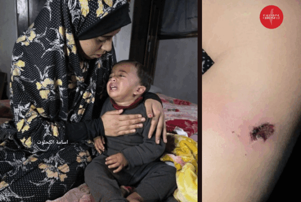 ‘Cigarette Burns, Nail Wounds’: Toddler Tortured in Gaza to Coerce Father ‘Cigarette Burns, Nail Wounds’: Toddler Tortured in Gaza to Coerce Father