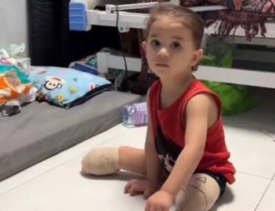 Hundreds of Gaza Amputees Stranded in Legal Limbo Hundreds of Gaza Amputees Stranded in Legal Limbo