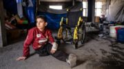 6,000 Gazans lack prosthetic and/or rehabilitation care – Daily Update
