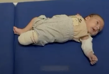 3-month-old Mohammad Al-Khatib was injured by the same Israeli strike that killed his mother as she was breastfeeding him.