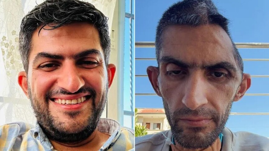 Journalist Bani Mufleh posted photo of himself showing part of his brain skull removed as result of surgeries he underwent while in Israeli detention
