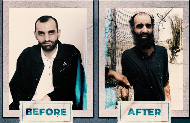 Photos of Palestinians Before and After Imprisonment by Israel Photos of Palestinians Before and After Imprisonment by Israel